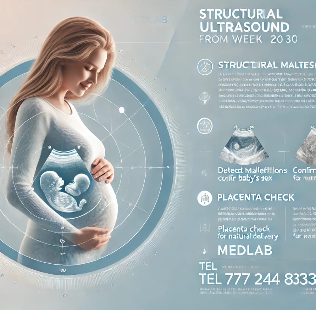 Información visual sobre ultrasonido estructural