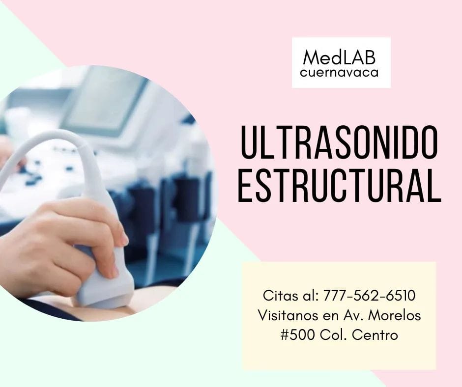 Equipo utilizado en ultrasonido estructural